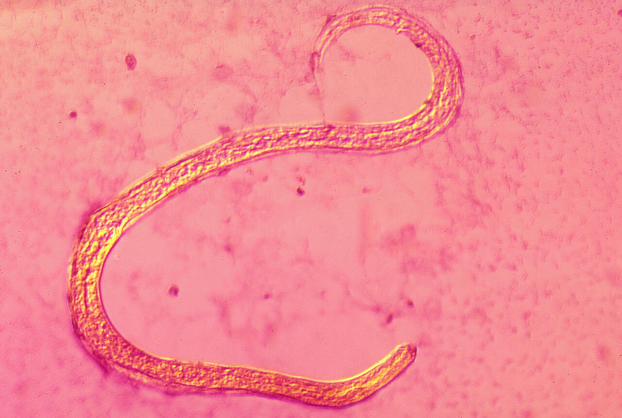 Strongyloides stercoralis parasite 