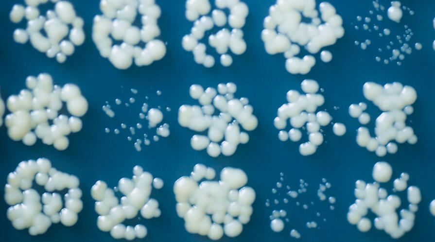 Yeast culture Yeast culture